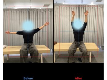 デン整骨院(DEN整骨院)/ゆがみ/肩こり/U24/学割/杉戸