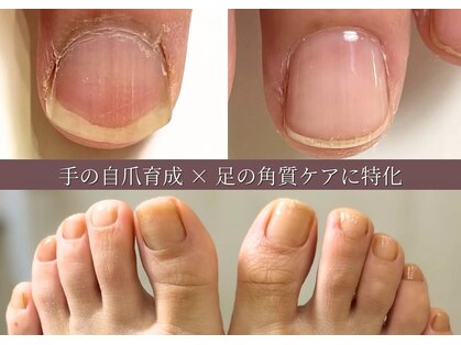 トワル(Towaru)の写真