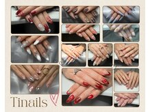ティネイル(Tinails)