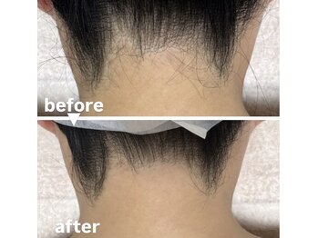 メゾン ド クロエ(Maison de Chloe)/↑【１度目ご確認】産毛のみ