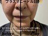 プラズマフェイシャル（単体）￥8000→6500　ヘッドスパ、マスクパック付き♪
