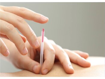 むげん整骨院 四条烏丸/鍼灸