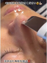 スピカ(Spica)/毛穴洗浄プラスで更にキレイ♪