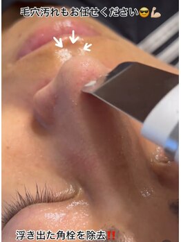 スピカ(Spica)/毛穴洗浄プラスで更にキレイ♪