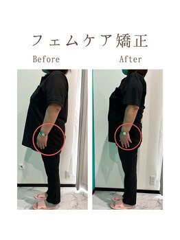 ルナ(Runa)/美容整体◆6回の効果