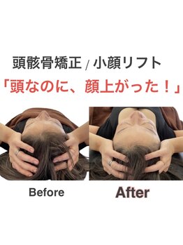 アサバ整体院 八潮店(ASABA整体院)/小顔リフトにも頭骸骨矯正