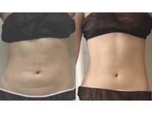 プリマルーチェ/プレミアムお腹プログラム