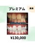 【シェアOK♪】美白セルフホワイトニング 2年通い放題 ¥130,000