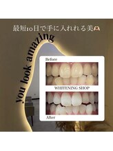 ホワイトニングショップ 緑橋店/最速ホワイトニングサロン◎
