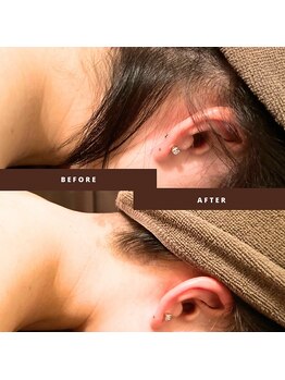 チャンティック(Cantik)/成人式のうなじケアのお客様♪