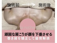小顔専門サロン ラリューシュ(La ruche)/肩こりが顔を下垂させる！