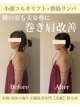 光癒(コウユ)/小顔コルギリフト×整筋リンパ