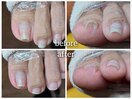 【フットケア】基本のネイルケア