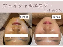 メナードフェイシャルサロン 中区平和