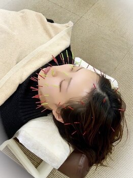 ながれかわ整骨院の写真/別府の口コミ大好評の整骨院！お肌の内側からアプローチしフェイスラインの引き締めや小顔効果も♪
