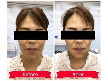 ドゥマイン(Do Mynd)/小顔