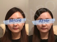 ティアラボ(TIARABO)/贅沢小顔|リンパマッサージ