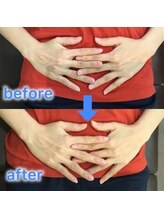 蕨整体院/産後2か月/産後骨盤矯正/蕨/整体