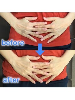 蕨整体院/産後2か月/産後骨盤矯正/蕨/整体