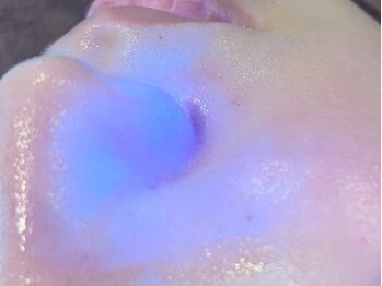 エム(M)の写真/【ごっそり毛穴洗浄！】当店独自の技法で蓄積された汚れを徹底除去！洗浄後に栄養補給を行うことで艶肌へ♪
