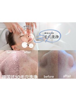 毛穴ケアをしたい