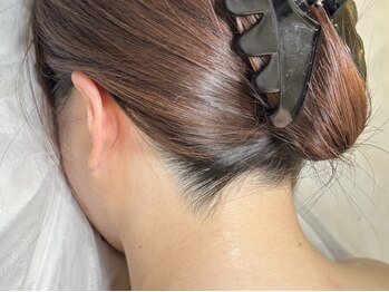 インベスト(INVEST)の写真/ここの部位だけ気になる...そんなお悩みも全て解決します!!VIO脱毛、うなじ脱毛が人気★