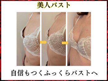 ニコ 岐南本店(Nico)/バスト★Before→after