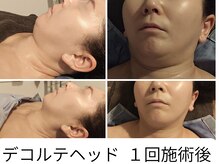 ヴェリタス(VERITAS)の雰囲気(張り付いていたのは胸と腕。お顔の前にお身体の施術が◎)