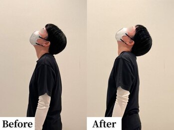 ソレア(Solea)/首こり改善1回目