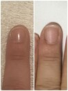 先端が弱く伸びなかった爪も縦長