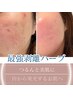 【最強剥離ハーブ】つるんと脱皮!最強ハーブ!30000→18000