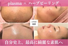 オッティモ(Ottimo)