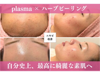 オッティモ(Ottimo)の写真