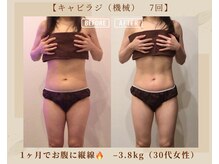 オキシー グレイス 黒崎店(OXY Grace)/キャビラジモニター 1ヵ月計7回