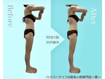 華(hana)/むくみスッキリ大量発汗