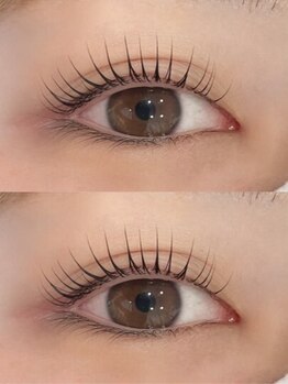 シェノン(CHAINON)の写真/NEWOPEN☆人目を気にせずリラックスした空間で施術が受けられる♪あなただけの時間をお届けいたします…♪