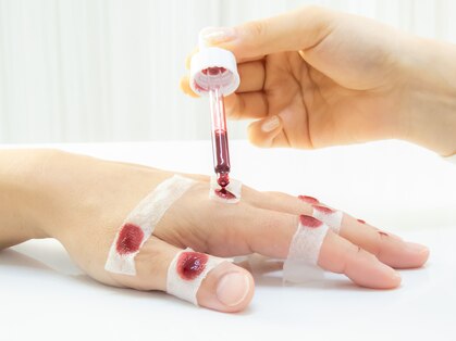 イユー(IU)の写真