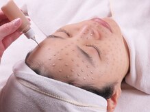 エステサロン ロティオン/落ちないファンデメソスキン