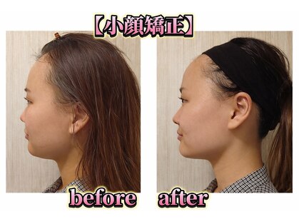 アットティービューティー 金沢文庫店(at tee...beauty)の写真