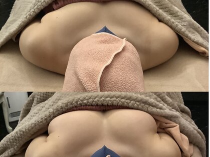 ベッピン(Beppin)の写真