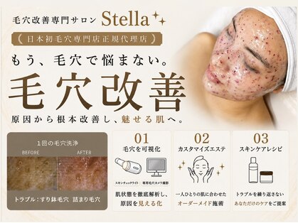 ステラ(Stella)の写真