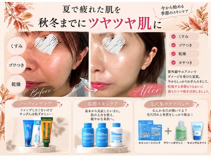エヌ(N)の写真