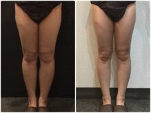 美容整体 ウェリナ 蟹江院/小顔矯正/骨盤矯正/美脚サロン 