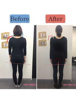 ステイゴールド美容整体院(STAY GOLD)/産後骨盤矯正（全身のゆがみ）