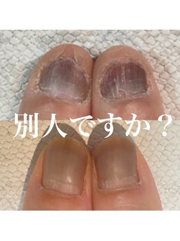 スティラ(Stila)/自爪育成/深爪育成/ネイルケア