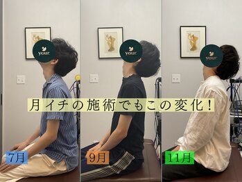 ユア(your.)/2週間に1度での変化 1