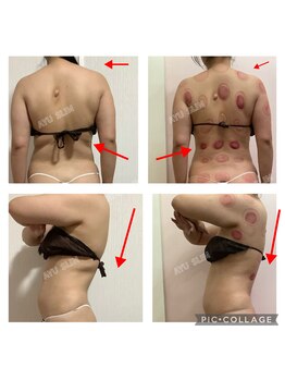 アユスリム(AYU SLIM)/短期集中ケア 充実痩身