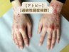 【慢性湿疹・かゆみを伴う皮膚・腸過敏】本気で健康を目指したい人向け！