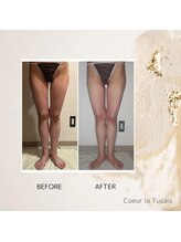 クーラ テュセ(Coeur la Tusais)/下半身集中痩身