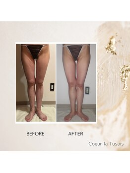 クーラ テュセ(Coeur la Tusais)/下半身集中痩身